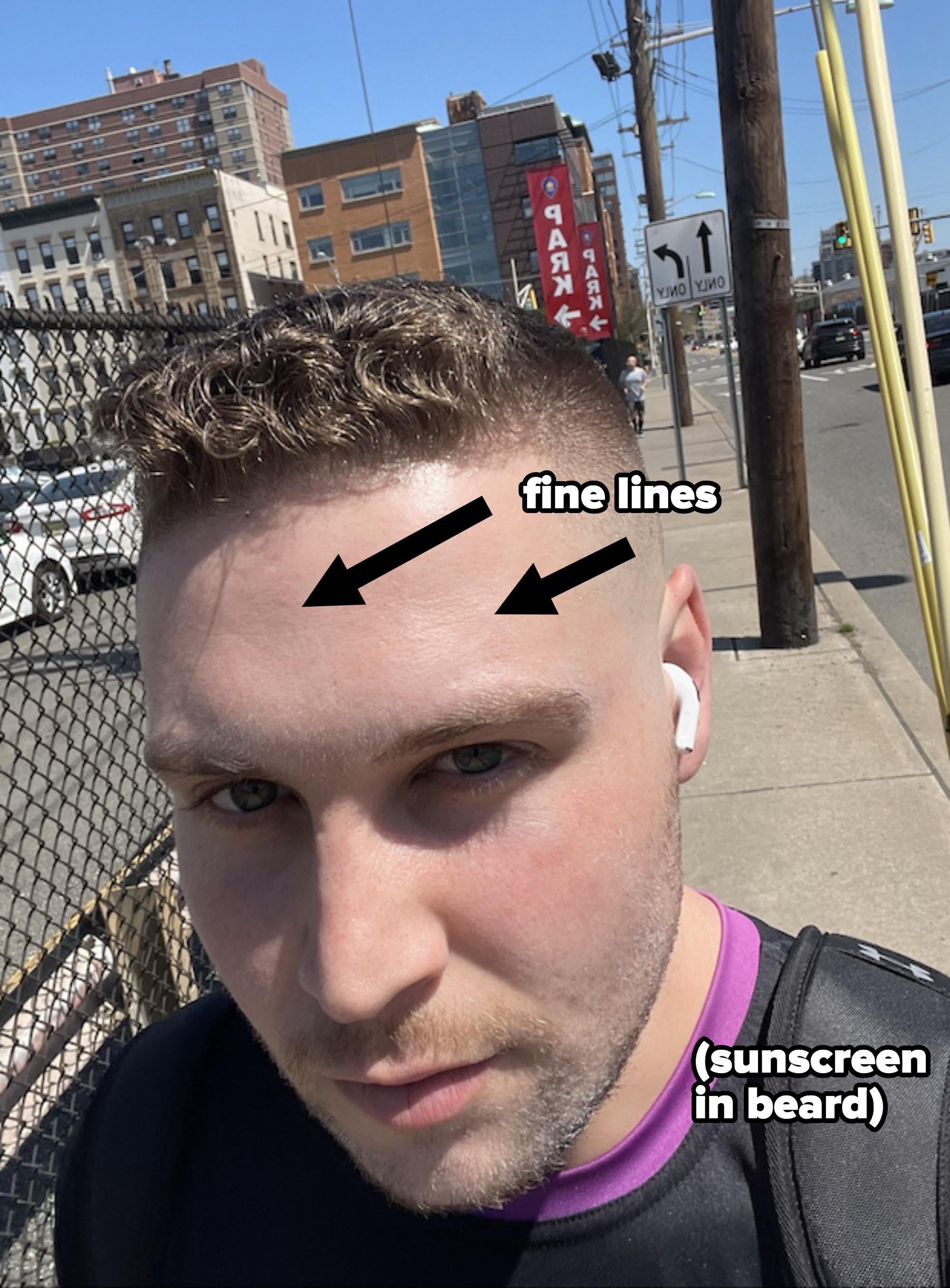 Close-up of the writer&#x27;s face with arrow pointing to fine lines on forehead and indicating sunscreen on beard