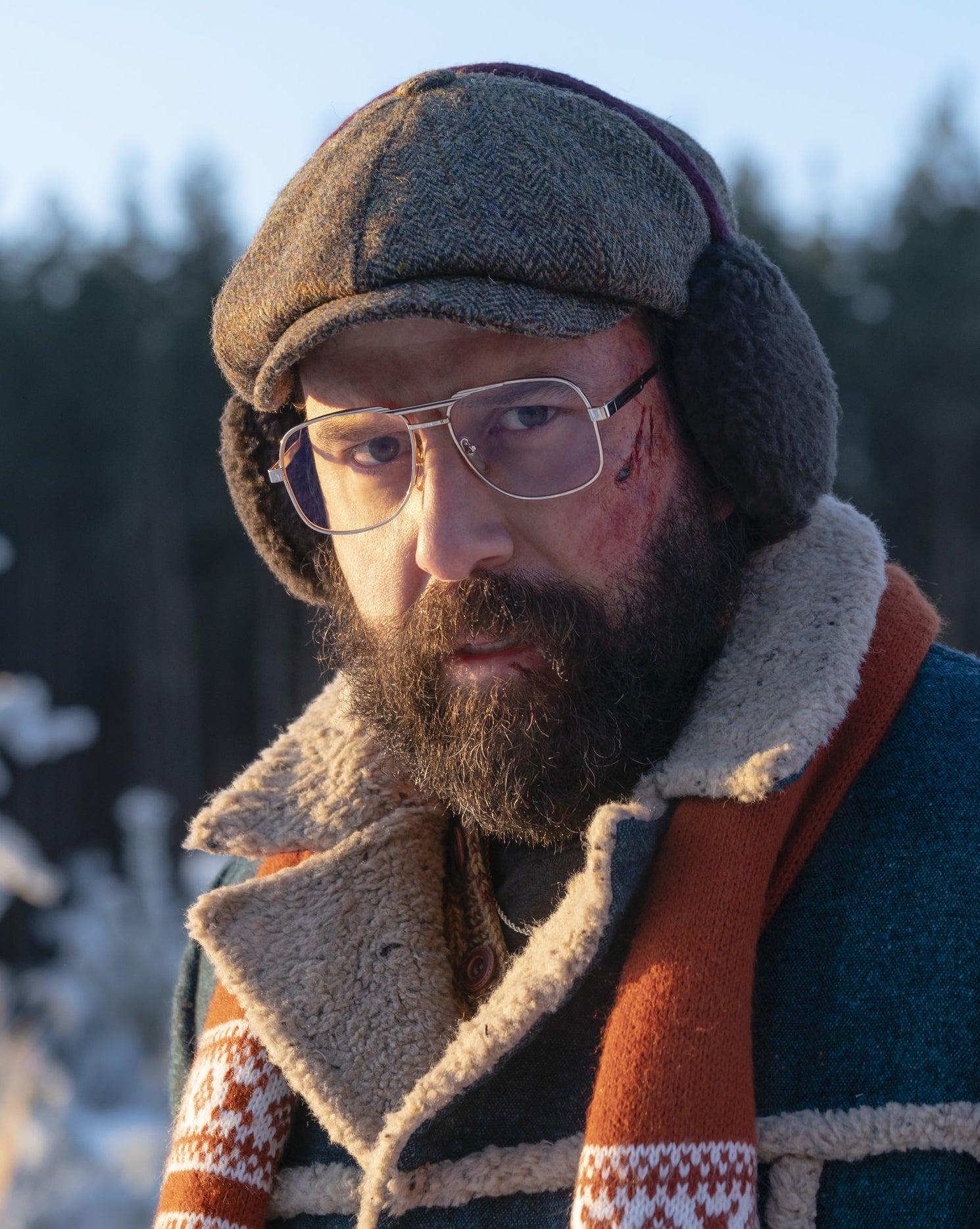 Brett Gelman with a blood-streaked face outside in the snow
