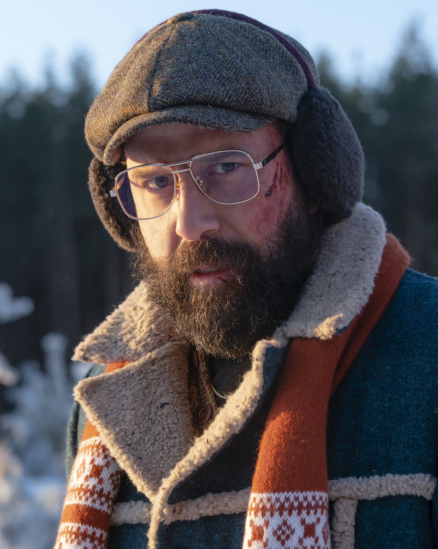 Brett Gelman with a blood-streaked face outside in the snow