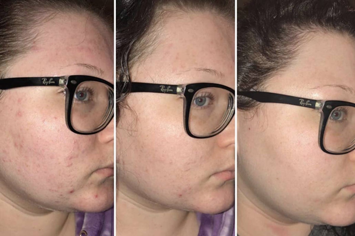 37 Face And Hair Treatments That Make A Difference 37 Face And Hair Treatments That Make A Difference