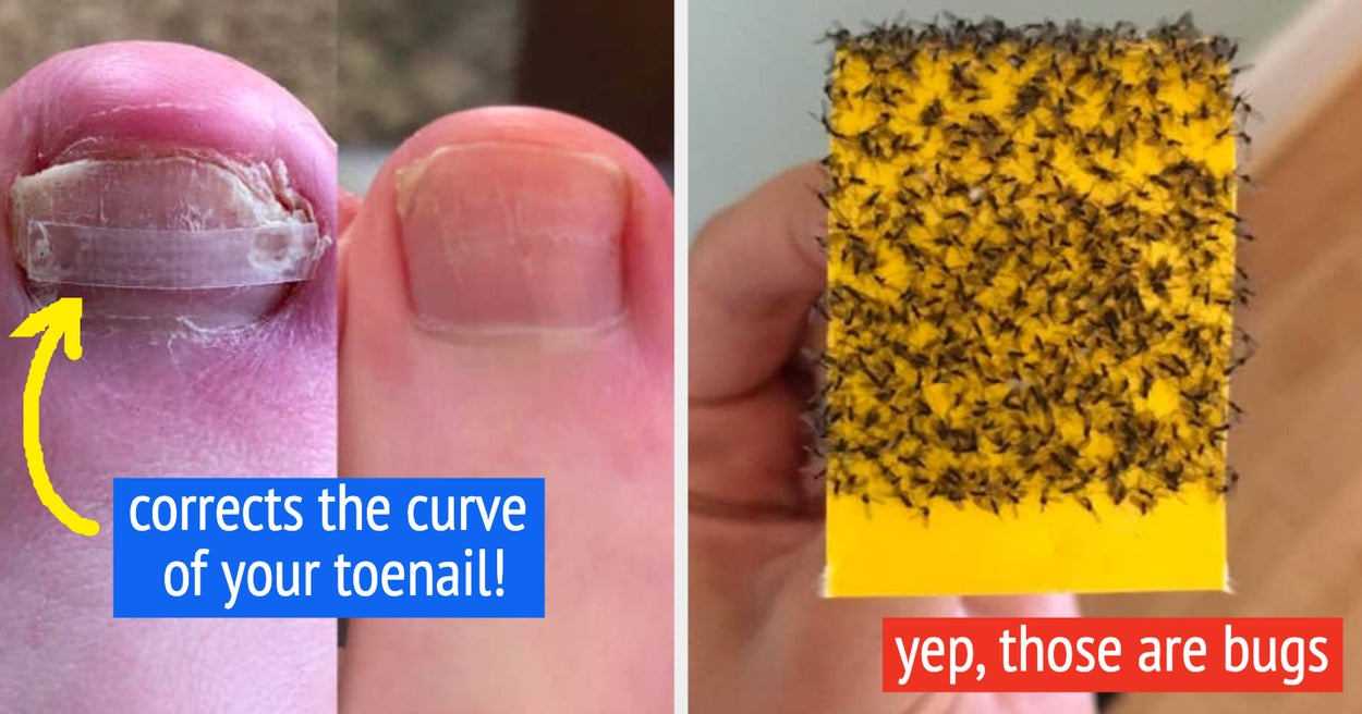 46 Really Disgusting (But Somehow Satisfying) Review Pictures And The Products That Lead To Them