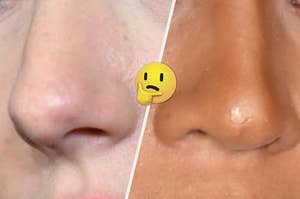 On the left, a close up of a nose, and on the right, a close up of a nose with a thinking emoji in between them