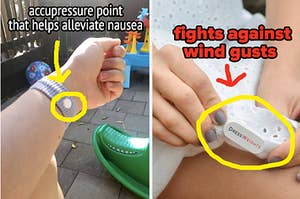 person wearing accupressure bracelet for relieving nausea, stick on dress magnet 