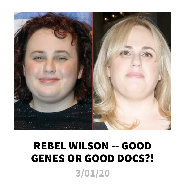 headline reading, &quot;rebel wilson good genes or good docs?&quot;