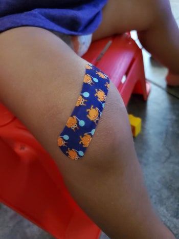 reviewer's photo of their child wearing the monster print bandage