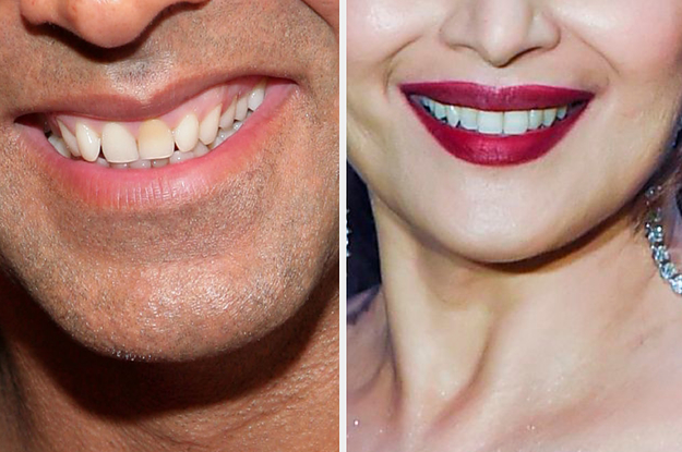 I Challenge You To Identify The Bollywood Celebrity Based On One Half Of Their Face