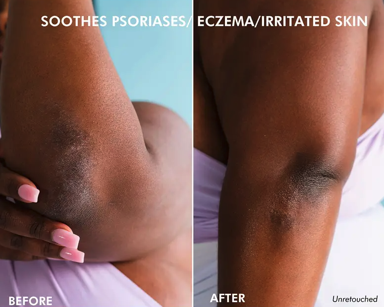 a before and after of a model&#x27;s elbows