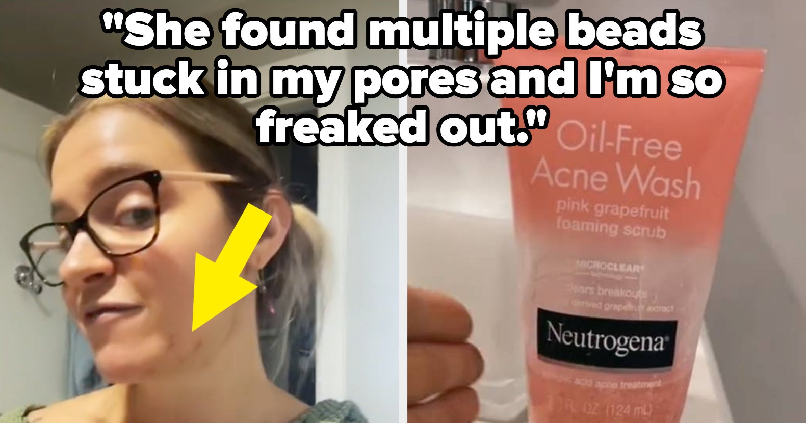 Neutrogena Grapefruit Face Wash Beads Stuck In Woman's Pores