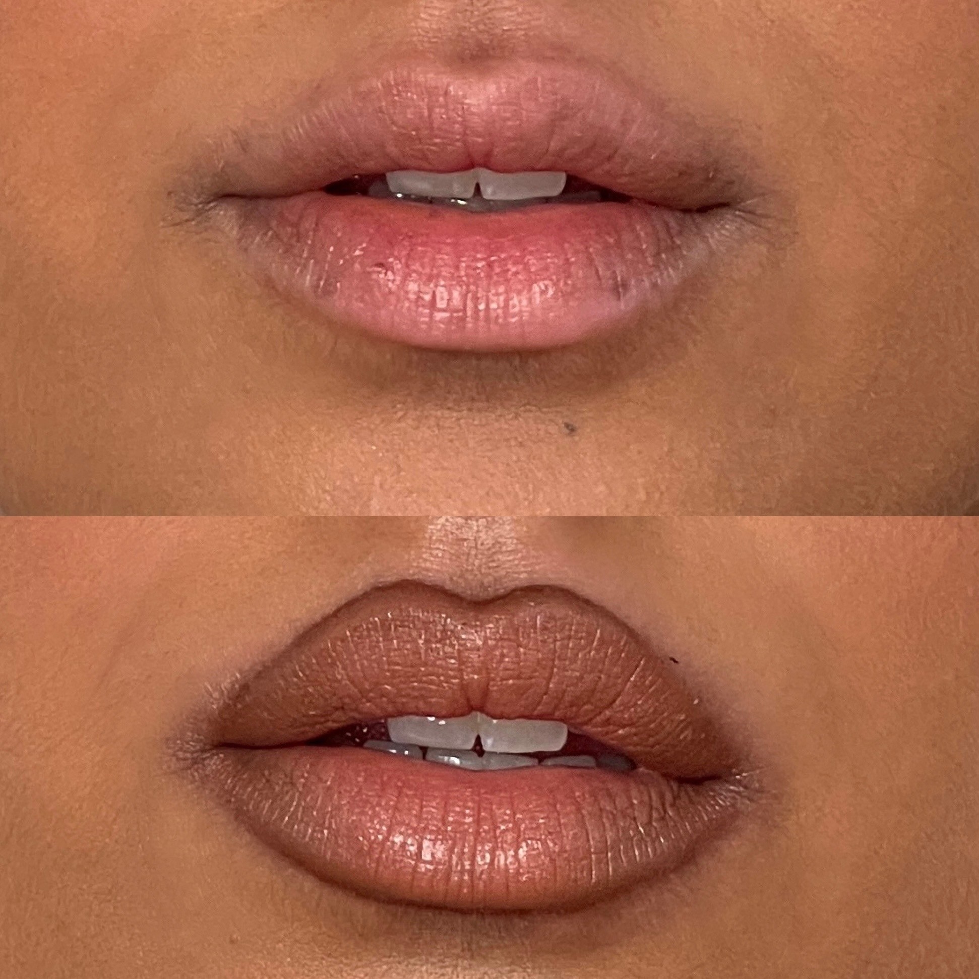 The difference with and without using this technique