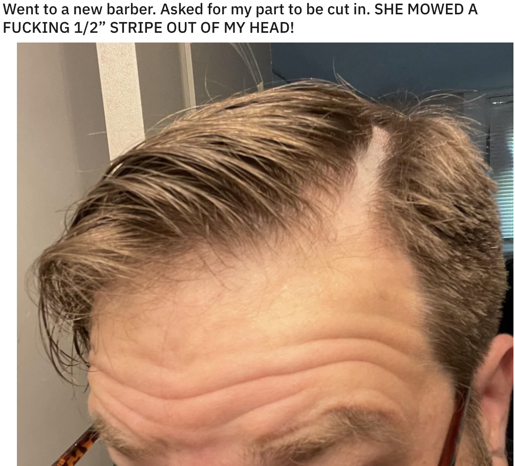 A bad haircut on a man