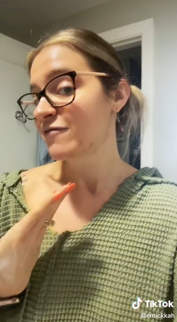 Emma pointing to scars on her face where the esthetician pulled out the beads