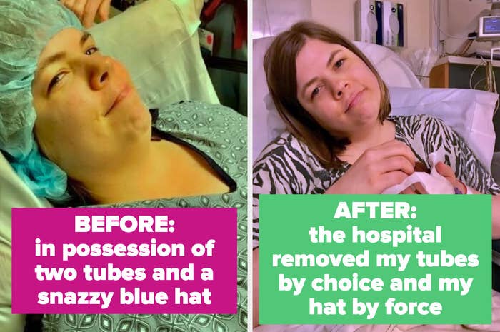 The author&#x27;s before and after photos from surgery