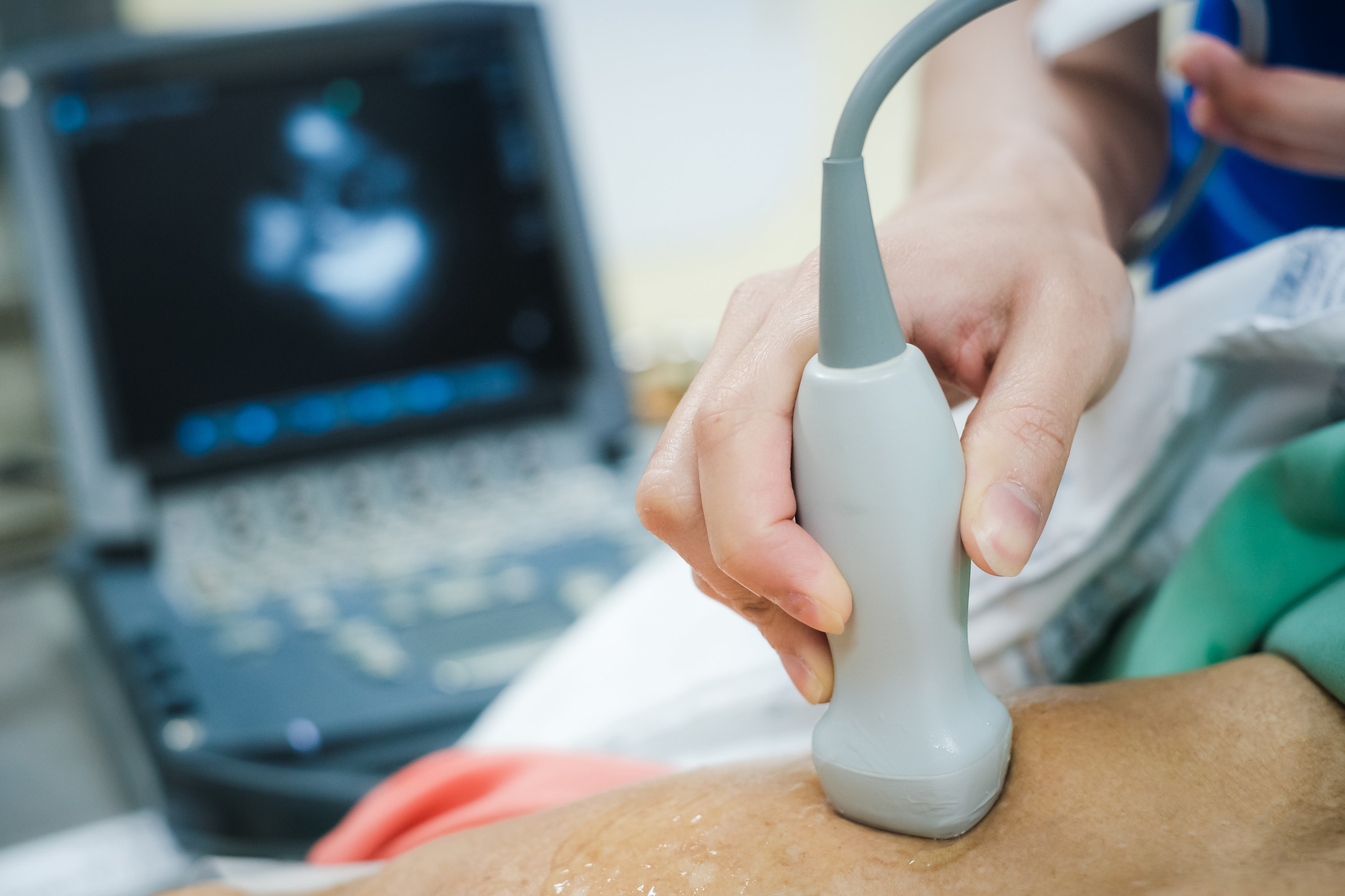 An ultrasound machine being used on a patient