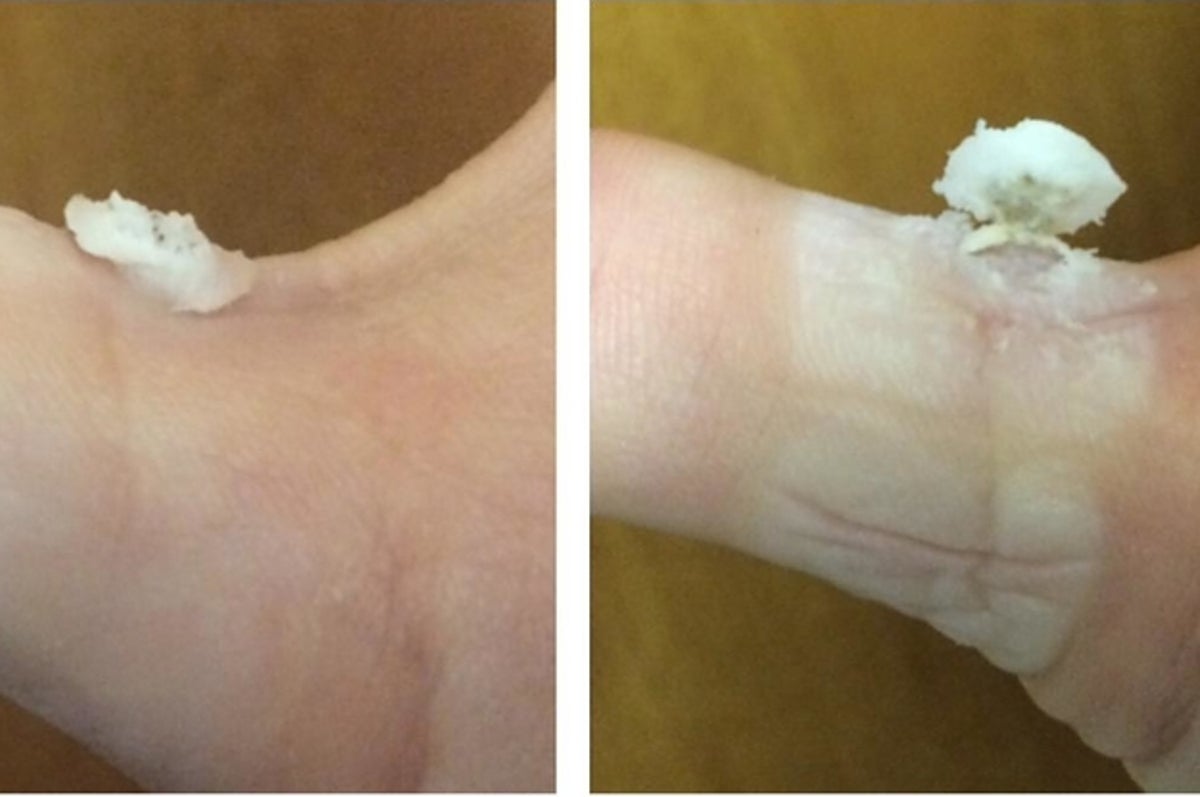 Before and after using foot wand! The results speak for themselves