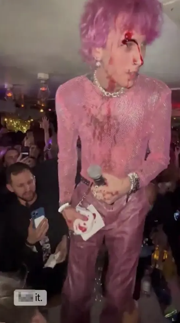 MGK with blood on his face and holding a microphone and tissues