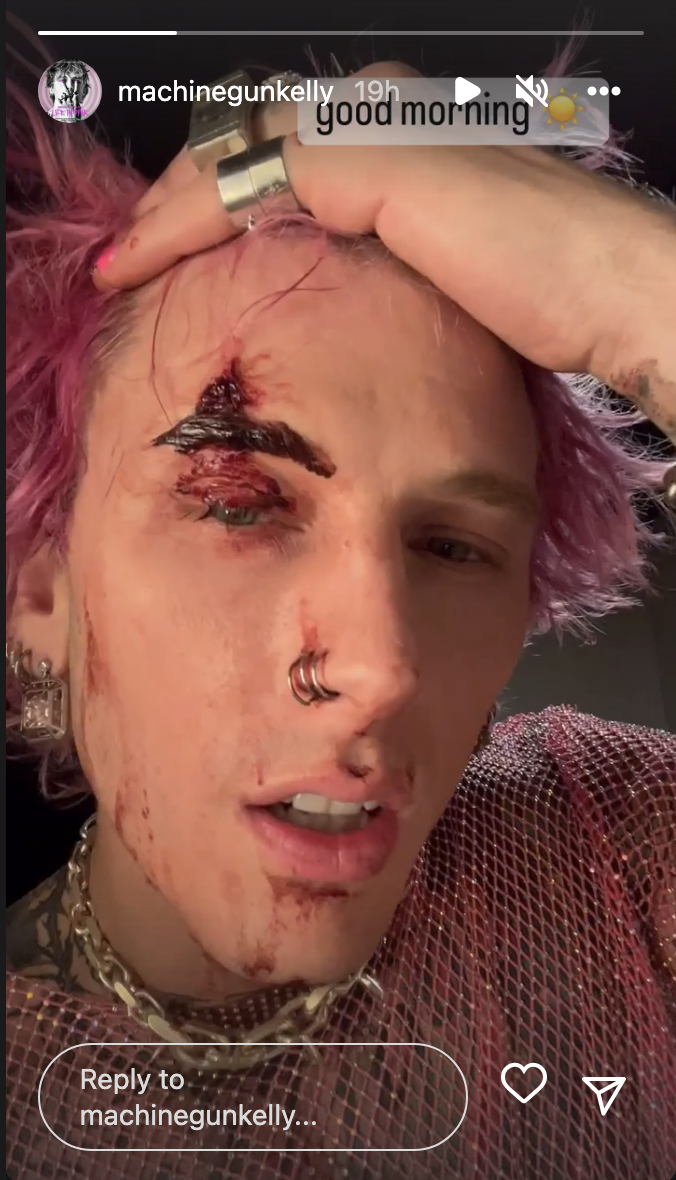 Close-up of MGK from his IG story with a bloody scar above his eyebrow and the text &quot;Good morning&quot;