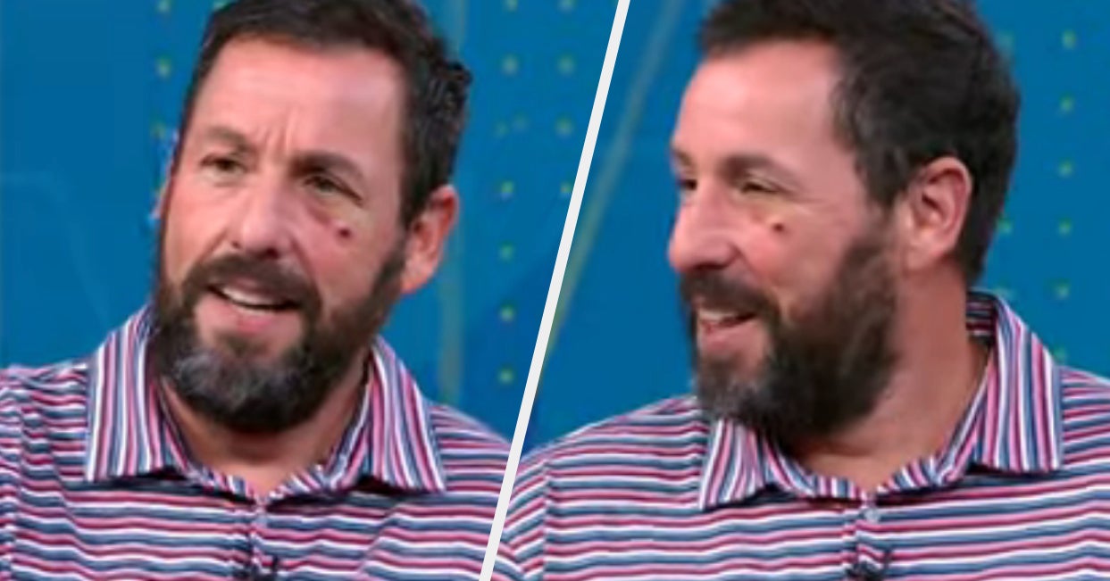 Adam Sandler Blamed His Black Eye On A Bizarre Phone Incident That Happened In Bed, And Yikes