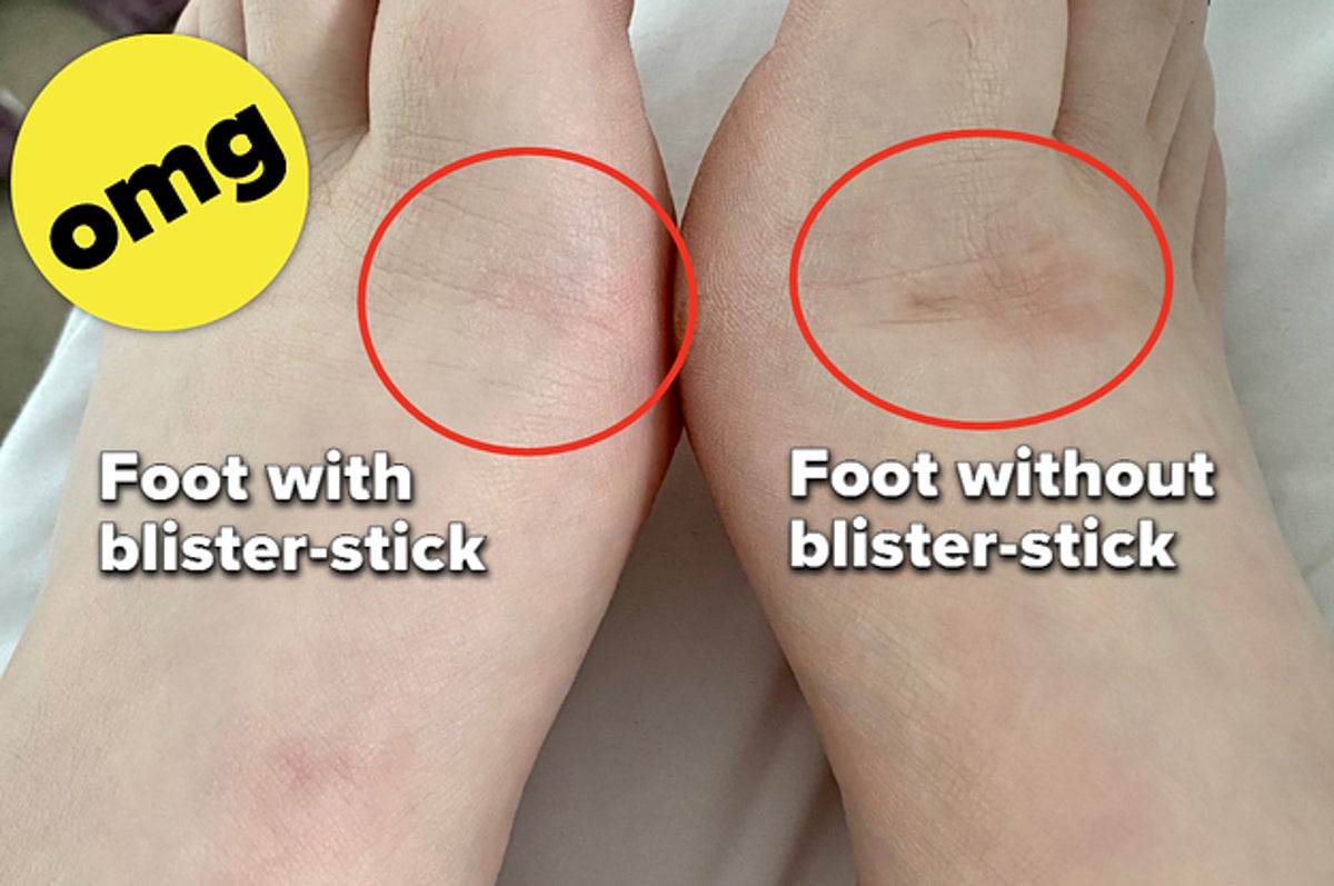 Readers Love This Anti-Blister Stick That's Under £5, So I Put It