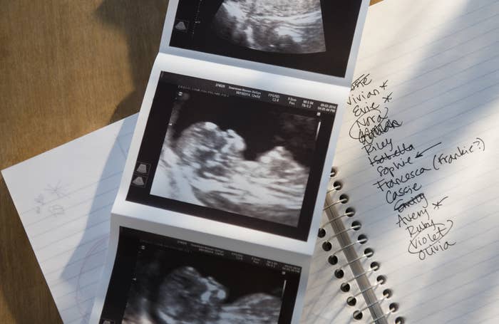 A sonogram laying on a sheet containing baby names