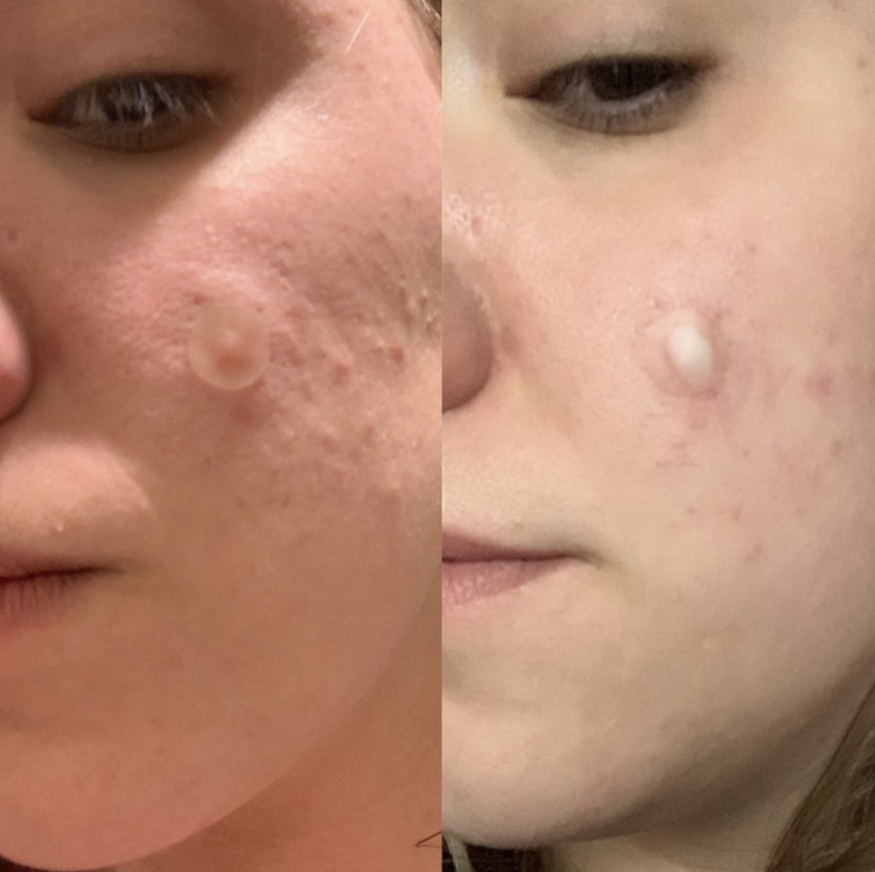 Reviewer before and after photo using patches