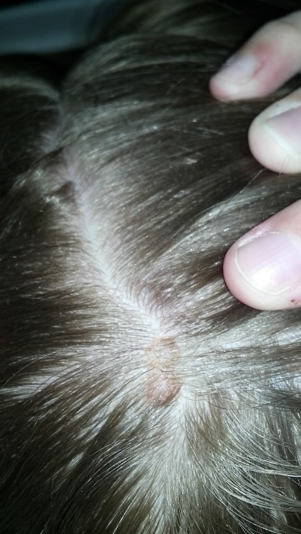 26 Birthmarks Shaped Like Really Cool Things