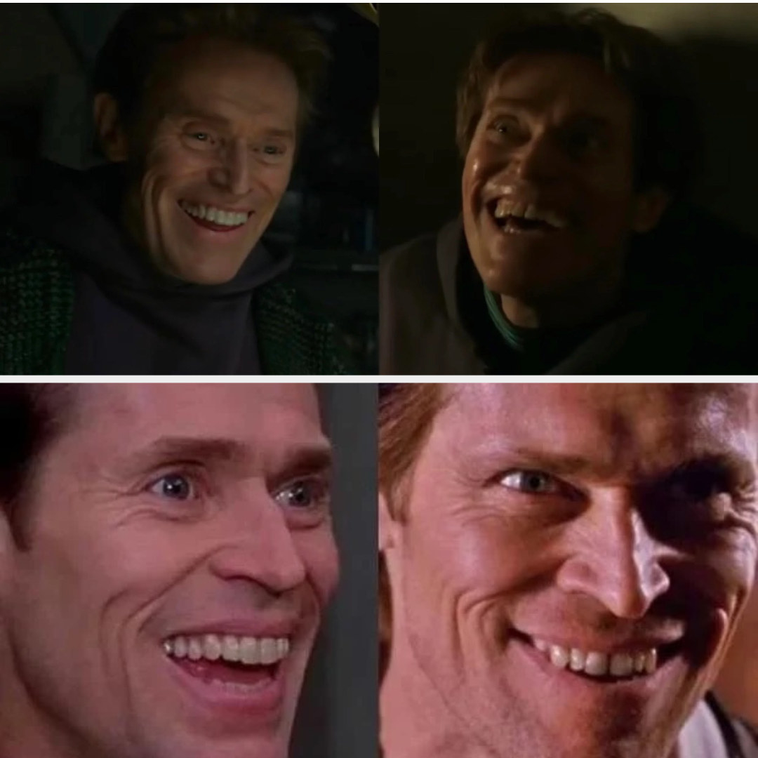 close up of the two different sets of smiles/teeth