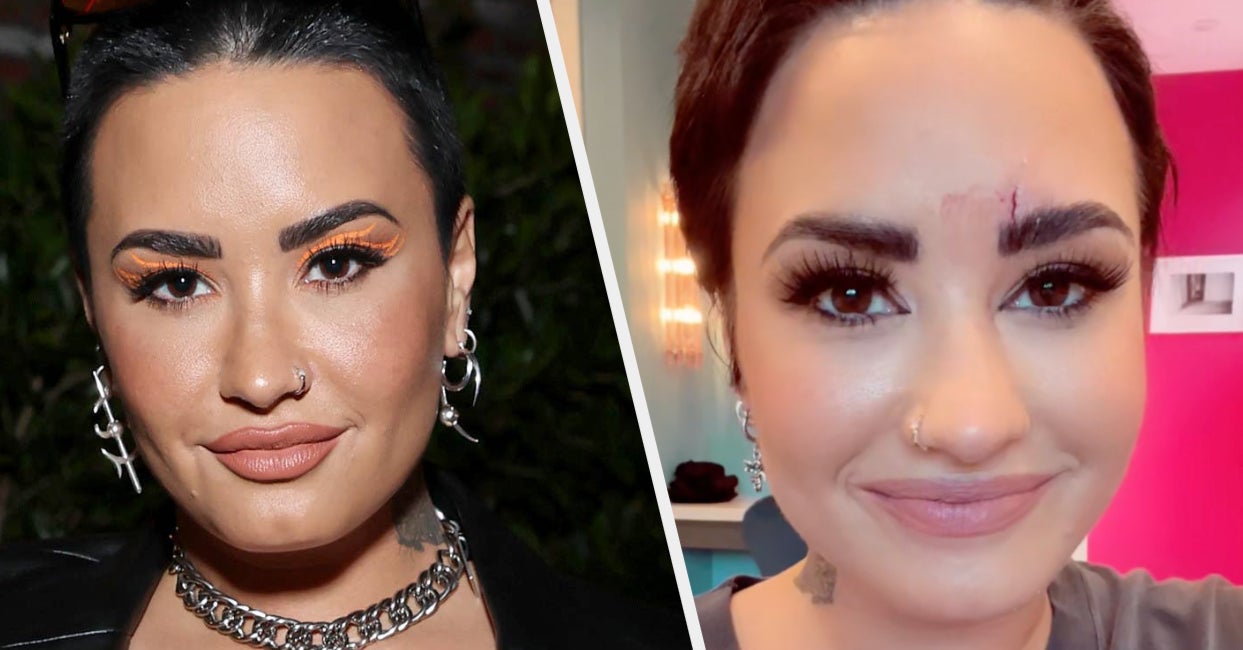 Demi Lovato Had To Get Stitches Because Of Her Giant Amethyst Crystal — And Made A TikTok About It Before She Told Anyone