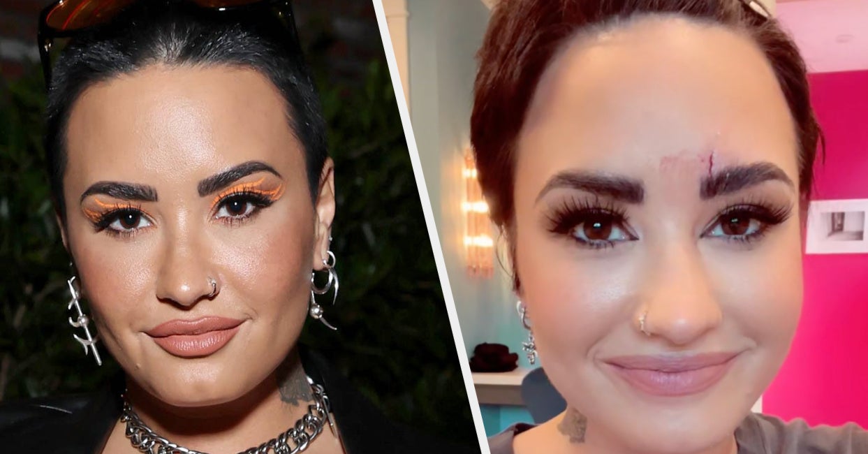 Demi Lovato Had To Get Stitches Because Of Her Giant Amethyst Crystal — And Made A TikTok About It Before She Told Anyone – BuzzFeed