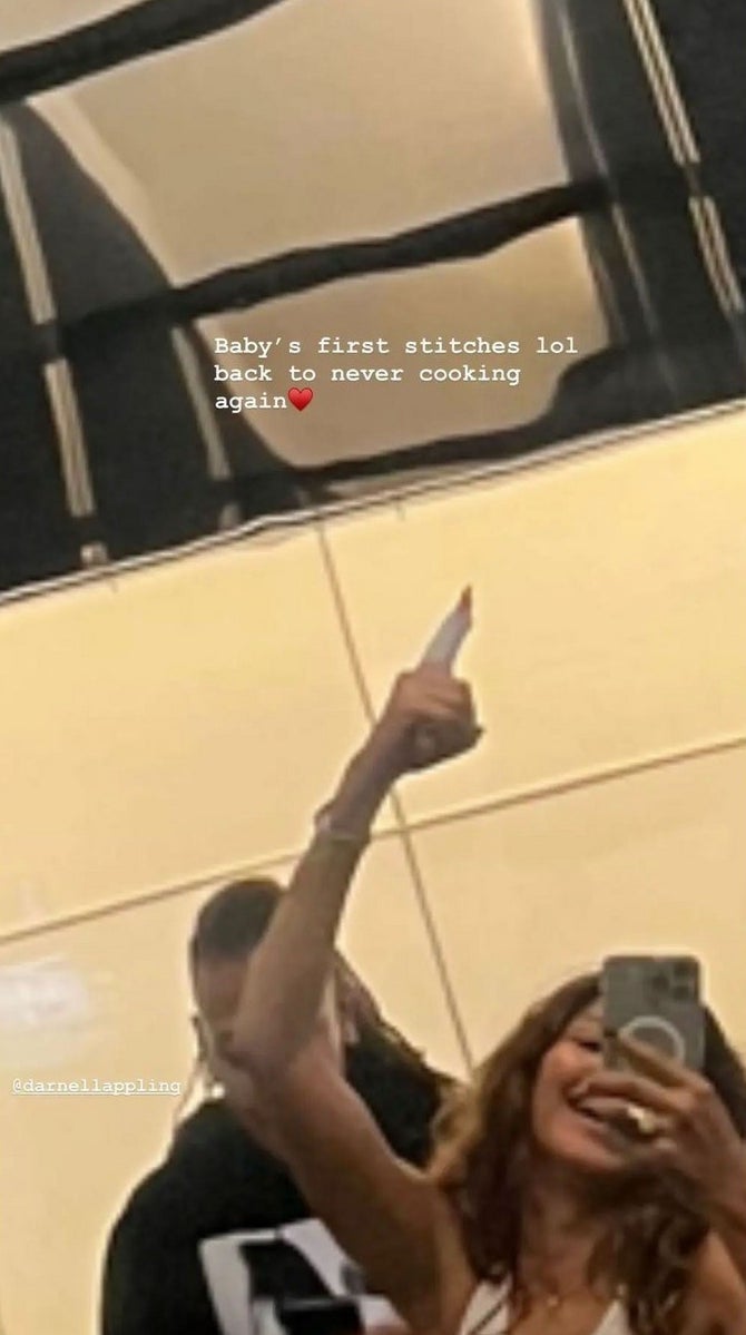 Zendaya holding up her hand under a caption that says "baby's first stitches"
