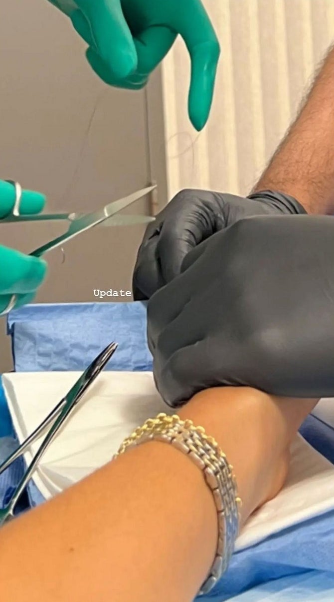 Two doctors working on Zendaya&#x27;s hand, one holding stitching thread and medical scissors