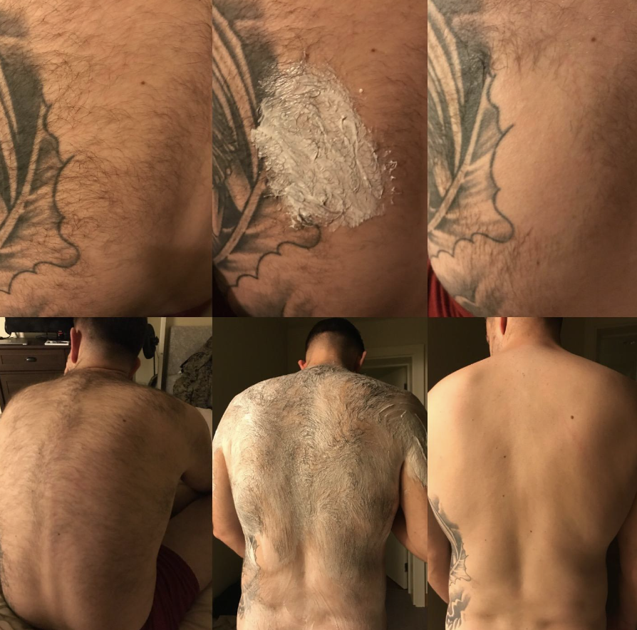 before and after of person's back covered in hair, completely hairless after use