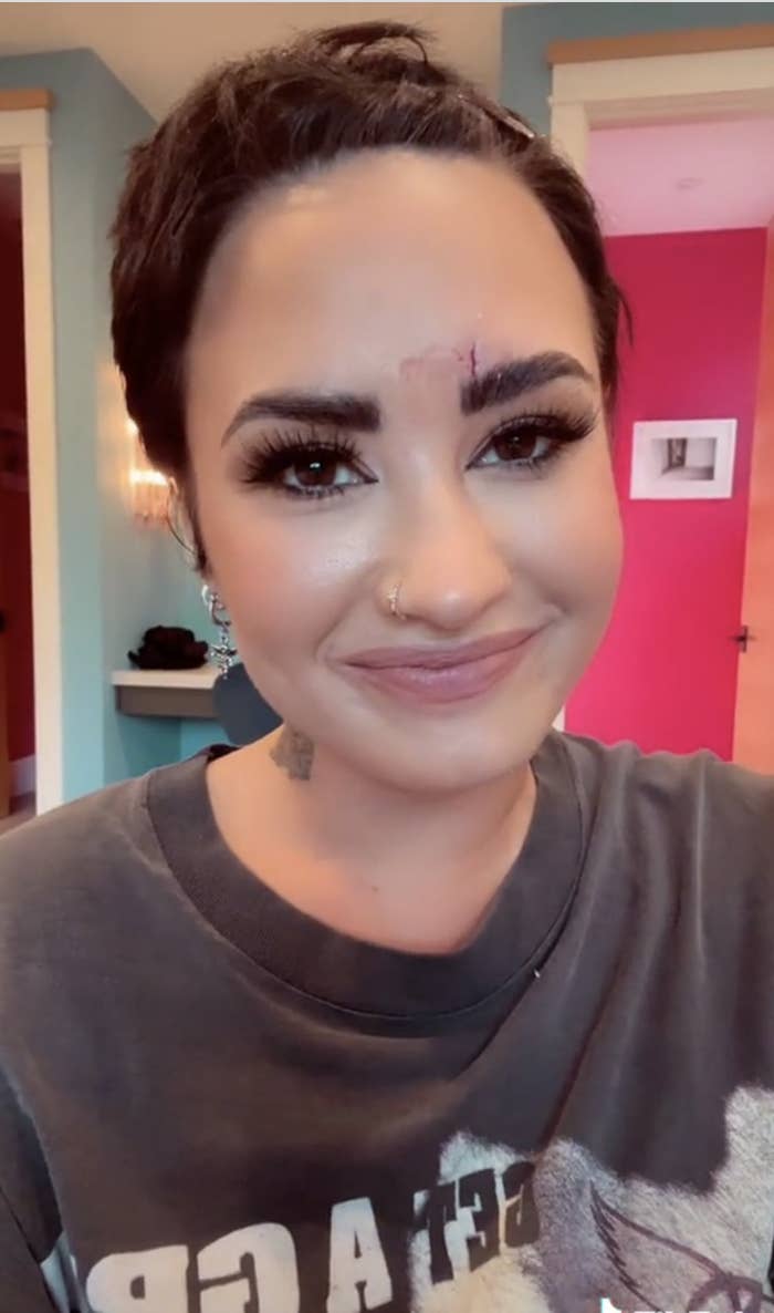 demi with a gash on their forehead