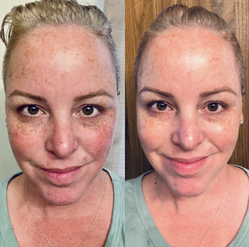 reviewer before and after of face after using face mask looks brighter and firmer