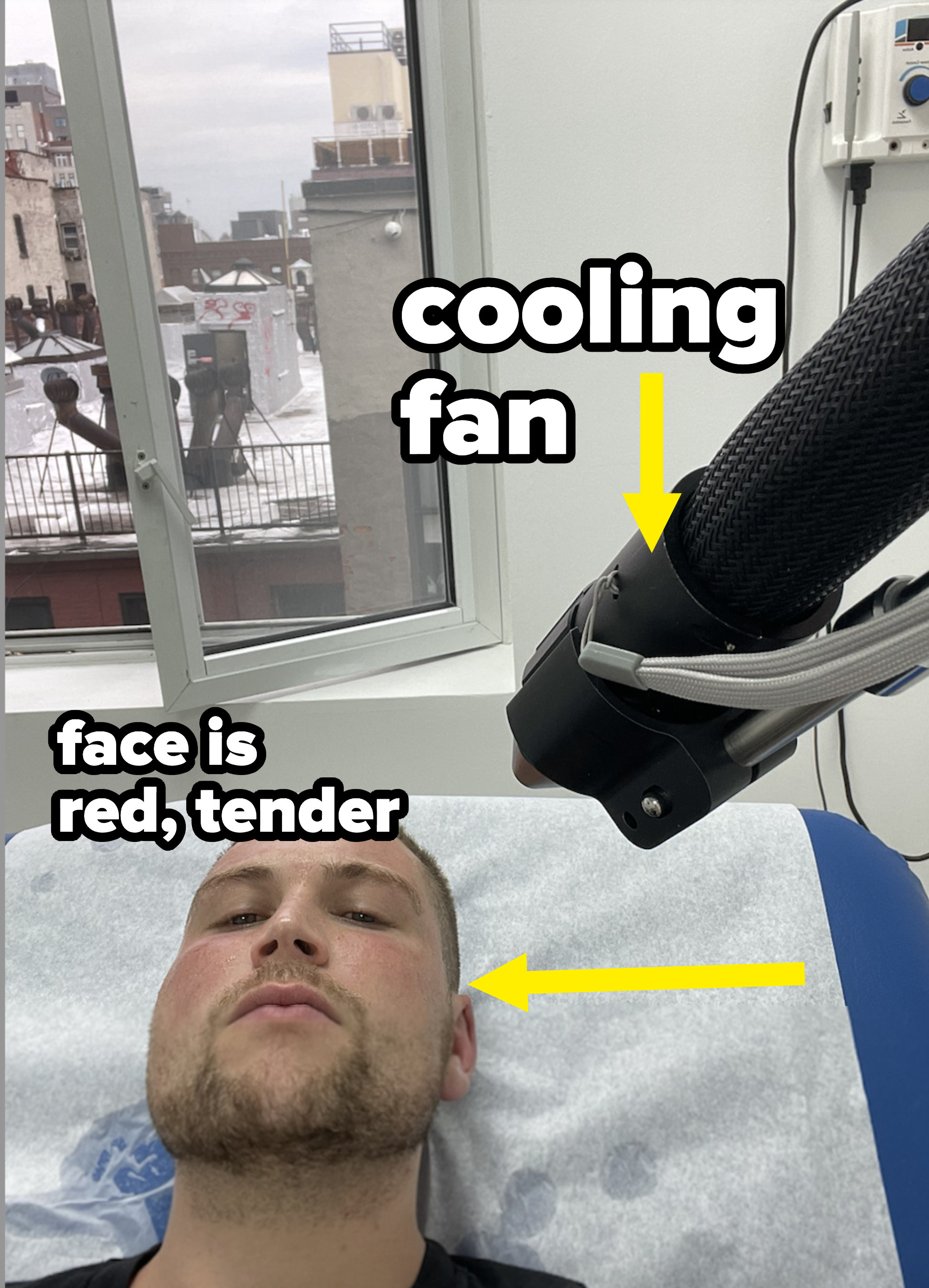 Cooling fan over Ryan&#x27;s skin