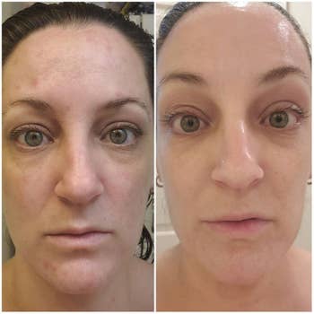 reviewer's before photo showing dull skin before using the cream and after photo showing their bright face after using the cream
