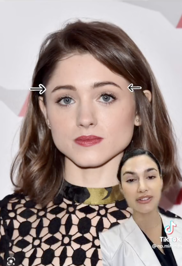 Arrows on either side of Natalia&#x27;s head point to her brow line