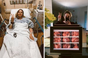 a side-by-side image of the author preparing for endometriosis surgery and the author posing with her surgery pictures