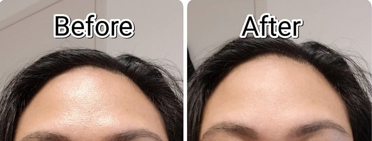 A reviewer&#x27;s photo of a oily forehead and a reviewer&#x27;s matte forehead after using the product
