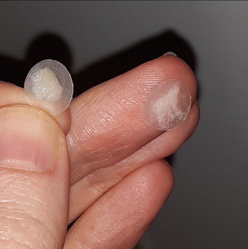 A reviewer holding clear patches full of white pus