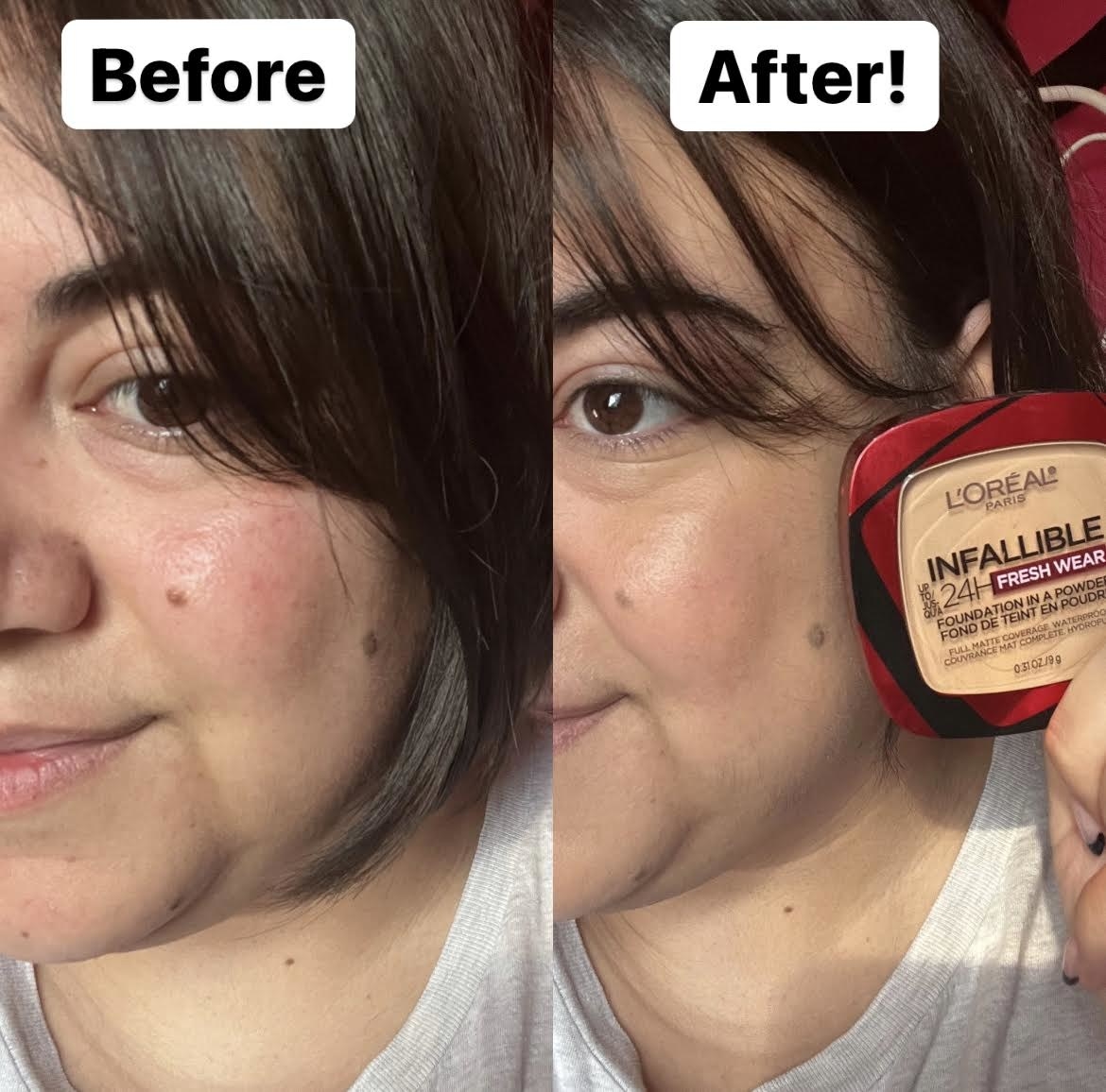 A before and after shot of Bianca&#x27;s face showing how the powder covered redness