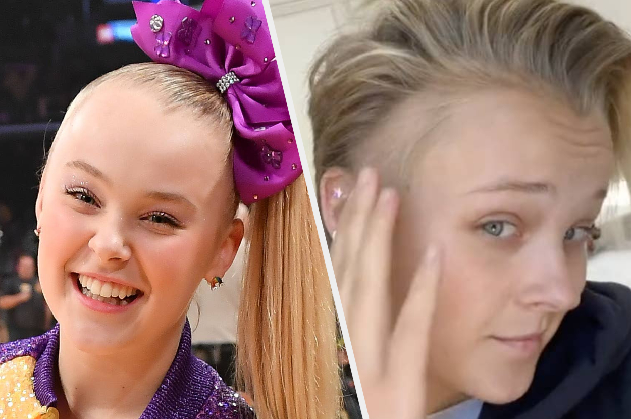 JoJo Siwa's Bald Spot And Stress Rash From Dance Moms