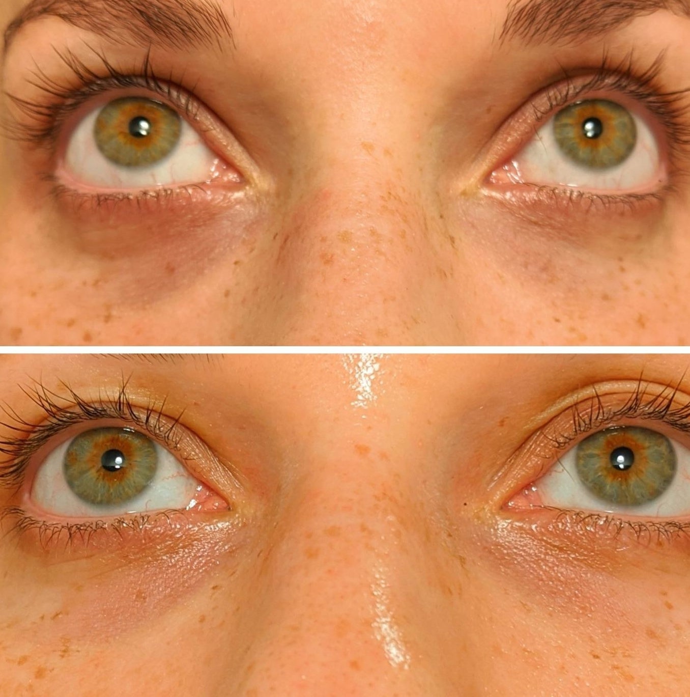 A reviewer showing their dark under eye circles before using this product and the reviewer's after photo of a much brighter and lighter under eye