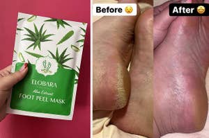 Bianca holding up the foot mask in front of a plain wall and a before and after photo of her feet