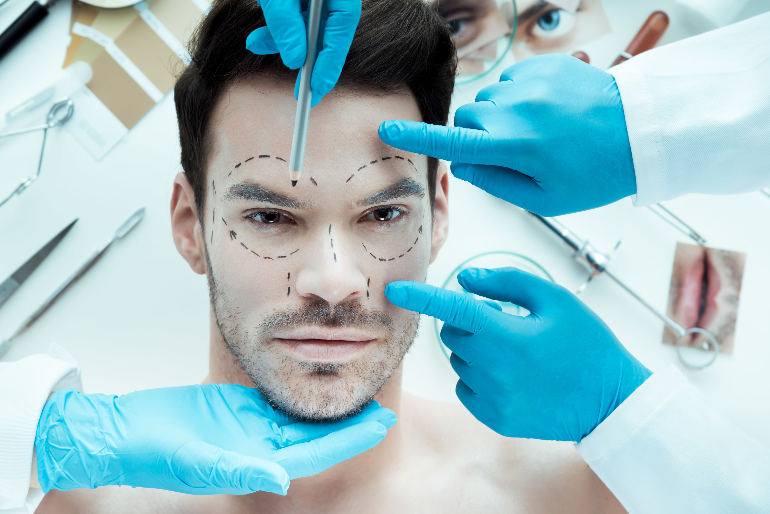 A man has lines drawn on his face and doctors inspecting him prior to a cosmetic procedure
