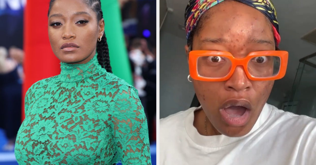 Keke Palmer Opened Up About Her Adult Acne and PCOS Diagnosis