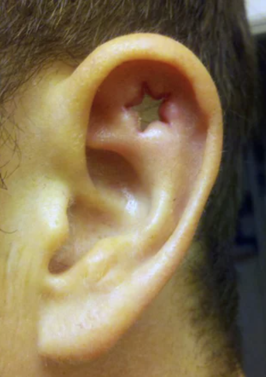 a star hole-punched into someone&#x27;s ear