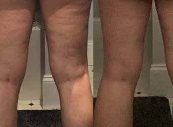 reviewer before and after of legs with loose skin before using the cream and legs with tight skin after using the cream