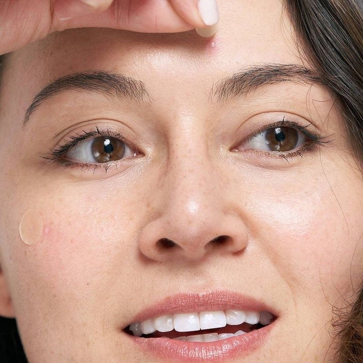 model applying the acne patches