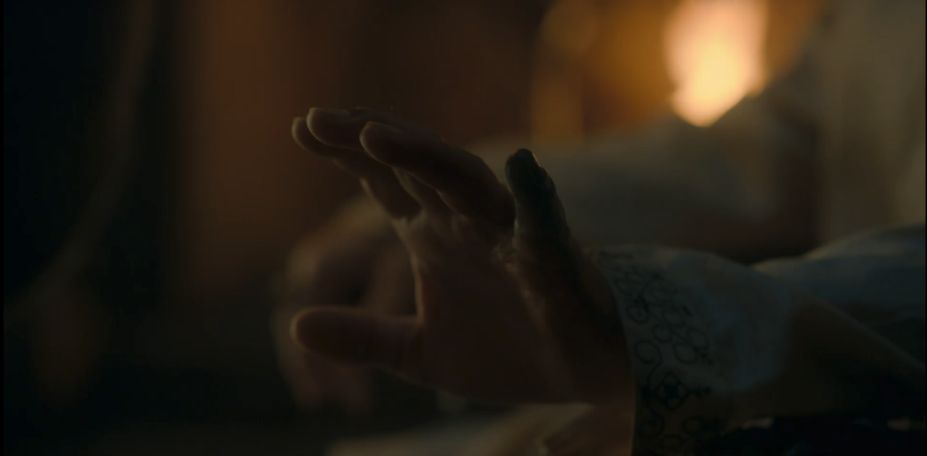 Viserys&#x27; hand - you can see that one of his fingers is black and rotting