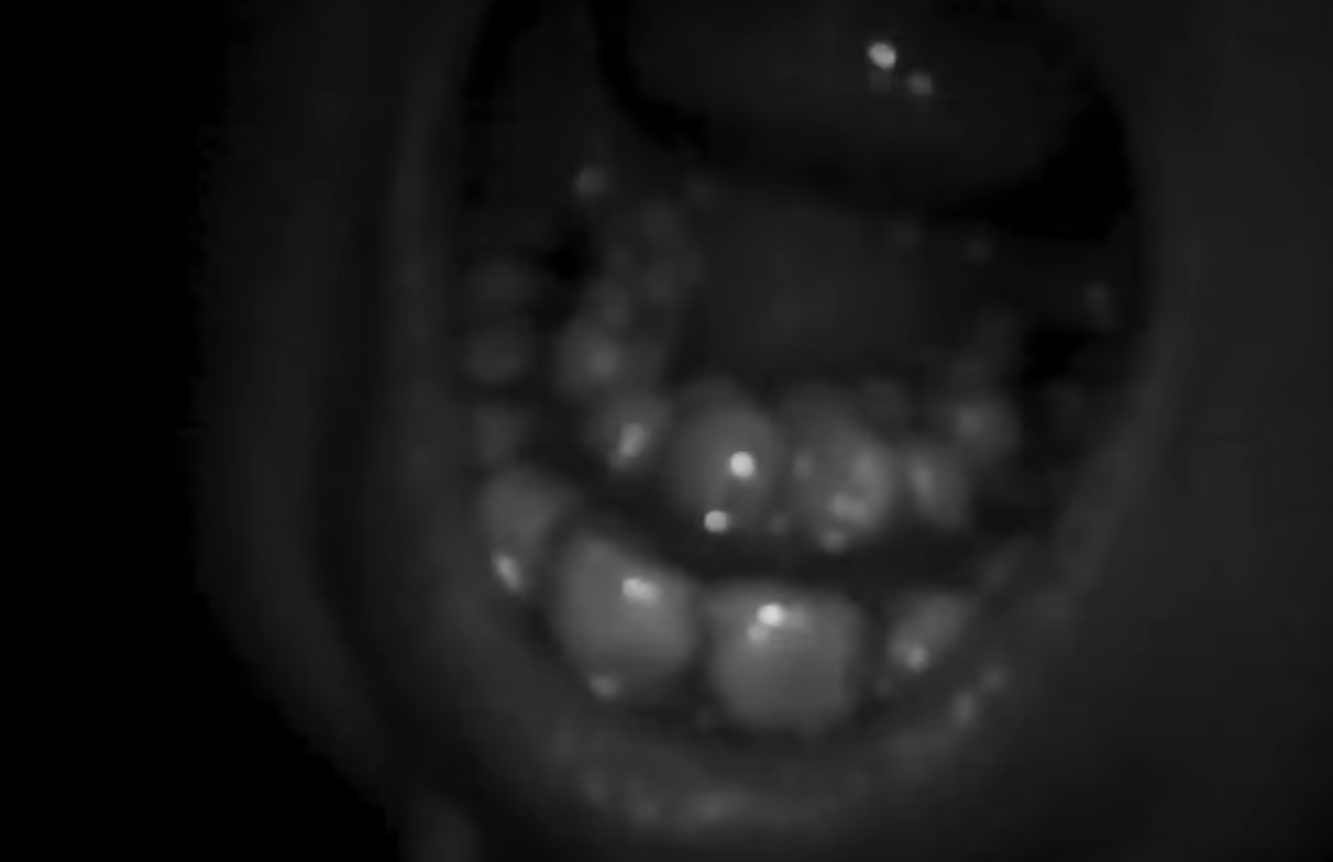 A mouth with two rows of teeth